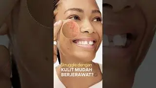 Kulit kamu mudah berjerawat? Mulai cegah penyebab jerawat dengan INNISFREE Retinol Cica Serum!