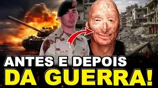 VEJA O ANTES E DEPOIS DESSES SOLDADOS - Chocante!