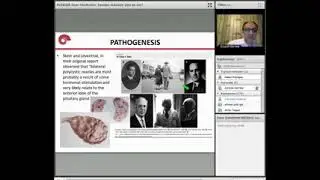 Polikistik over sendromu  Tanıdan tedaviye yeni ne var  Prof Dr Özgür Öktem