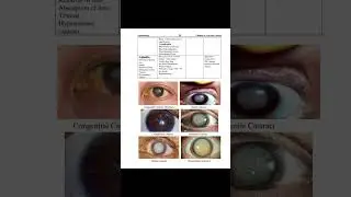 MBM’s Ophthalmology |60 cases of Eye| MBM medical Books series |