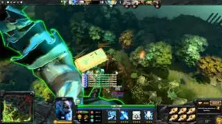 Dota 2 - 150 Foot Tall Undying
