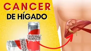 Impactante Vínculo entre las Bebidas Azucaradas y el Cáncer de Hígado
