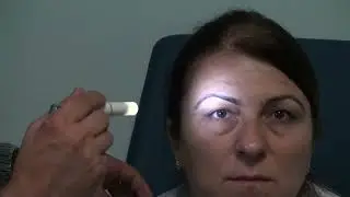 Göz Işık Refleksi Muayenesi