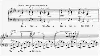 LCM Piano 2013-2017 Grade 8 B1 Chopin Nocturne in C# Minor Op. Posthumous Sheet Music