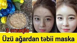 10 dəqiqəyə üz maskasi ağardıcı