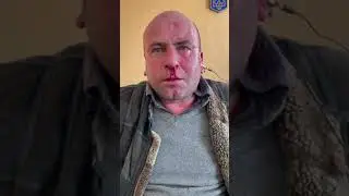 Прямое доказательство пыток украинцев электро током и насильнойзаписи в армию непризнанных республик