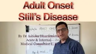 Adult Onset Still’s Disease