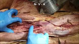 POPLITEAL Region Muscles Neurovascular Structures and Clinical Aspects – Sanjoy Sanyal