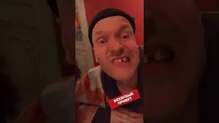 Беззубый привет #юмор #орехов #прикол #бэкстейдж #смех #топ #fynnyvideo #shortscomedy #fun #зубы