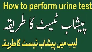 How to use Urine test strips Combur 10