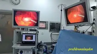 PANKREAS KANSERİ TEDAVİSİNE DOĞRU BAŞLANGIÇ NASIL OLMALI? PROF DR ÜNAL AYDIN