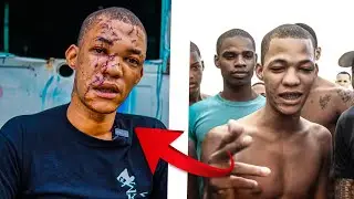 They left him unrecognizable. He was abused by seven people. See the reason.