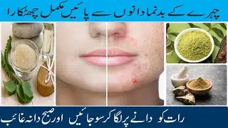 how to remove pimples overnight acne treatment | how to get rid of pimples acne  marks in 3 days