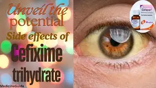 Unveil the Potential Side Effects of Cefixime Trihydrate #cefiximetrihydrate #indigestion #jaundice