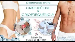 CRIOFREQUÊNCIA RESULTADOS E DIFERENÇA DA CRIOLIPÓLISE!