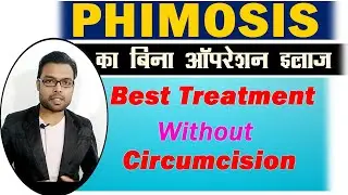 Phimosis का बिना सर्जरी इलाज  | Phimosis Treatment | Phimosis Cure | Phimosis