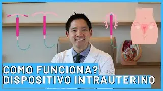 Como Funciona o DIU: Tudo o Que Você Precisa Saber Sobre o Dispositivo Intrauterino