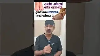 കാലിൽ പതിവായി നീര് വന്നാൽ ഏതൊക്കെ രോഗങ്ങൾ സംശയിക്കാം ?