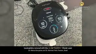 Leukoplakia removal with the D-Storm™ Diode Laser