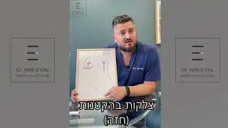 צלקות בניתוח הקטנת חזה - ד
