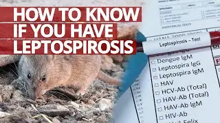 How to know if you have Leptospirosis #Lifesaver