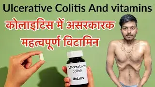 Ulcerative colitis and vitamins / अल्सरेटिव कोलाइटिस के महत्वपूर्ण विटामिन / colitis treatment hindi
