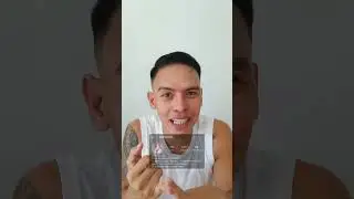 MAGKANO INABOT NG RHINOPLASTY AT SINO ANG DOCTOR KO