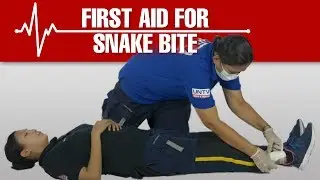 How To Treat or give First Aid to a Snake Bite? 
