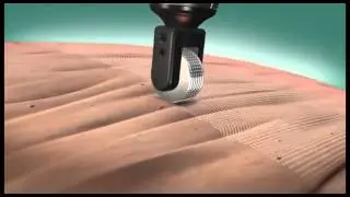 Skin Resurfacing, Pixel RF from Alma Lasers