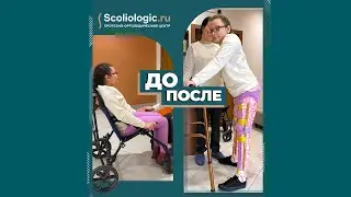 Аппараты при вялом тетрапарезе