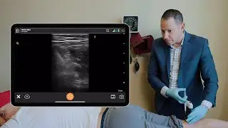 iPACK Pain Injection