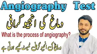 What is the process of angiography?||دماغ کی انجیوگرافی
