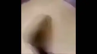 На пацана напала собака и сделала бака бака