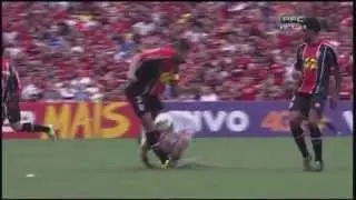 Lesão Bruno Aguiar