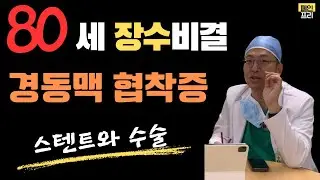 경동맥 협착증의 치료, 스텐트와 수술, 2부 #신경외과 #뇌졸중 #뇌졸중전조증상 #뇌경색 #스텐트 #수술