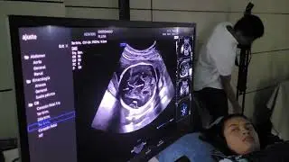 Sonoacademic Cartagena Junio 2023. Dr. Saulo Molina trabajando con el Hera w10 Elite.