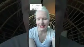 Albinism | 🤍
