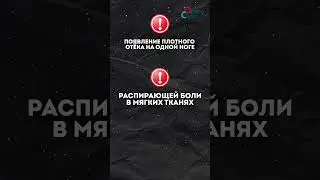 Отёк на одной ноге. Что делать?