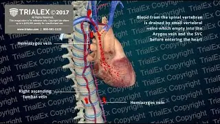 The Mechanism of DIC - Disseminated Intravascular Coagulation