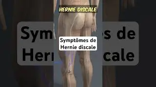 Mal de dos depuis 3 semaines et fourmillements dans la jambe ou dans le pied
