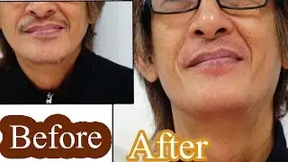 แว๊กซ์หนวด โดยแว๊กซ์น้ำผึ้ง กำจัดขน /พี่กระต่าย