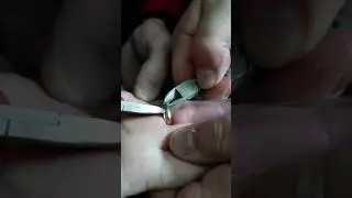 Спасение женского пальчика #мчсроссии #службаспасения #спасатели #помощьлюдям #сво #псп #чп #чс