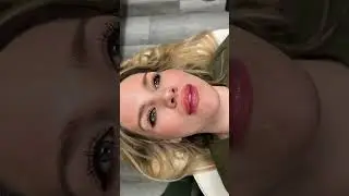 Lips fillers