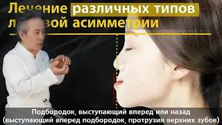 Для чего нужно исправлять лицевую асимметрию?