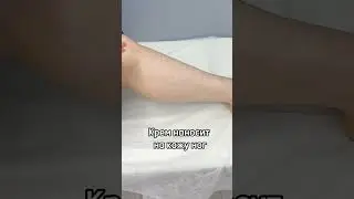 Мазь от варикоза. Флеболог Москва.