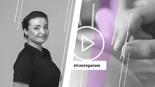 Игло­терапия| Dry Needling| Что это такое?