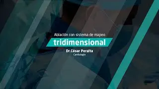 Ablación con sistema de mapeo tridimensional - Clínica Ricardo Palma