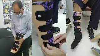 #Partial Foot #Prosthesis by Mazhar Hussain Tazagrami