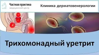 Трихомонадный уретрит