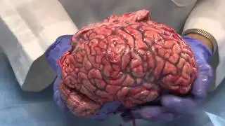 The Normal Unfixed Brain: Neuroanatomy Video Lab - Brain Dissections [ARCHIVE]